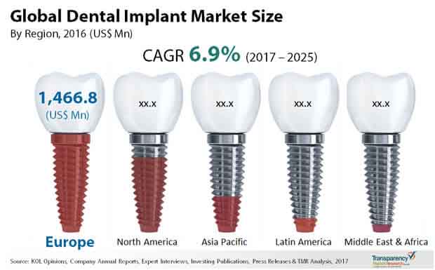 global dental implants market