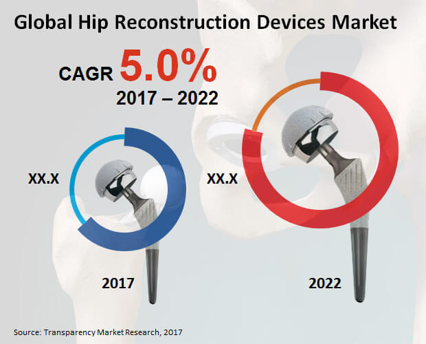 hip reconstruction devices market